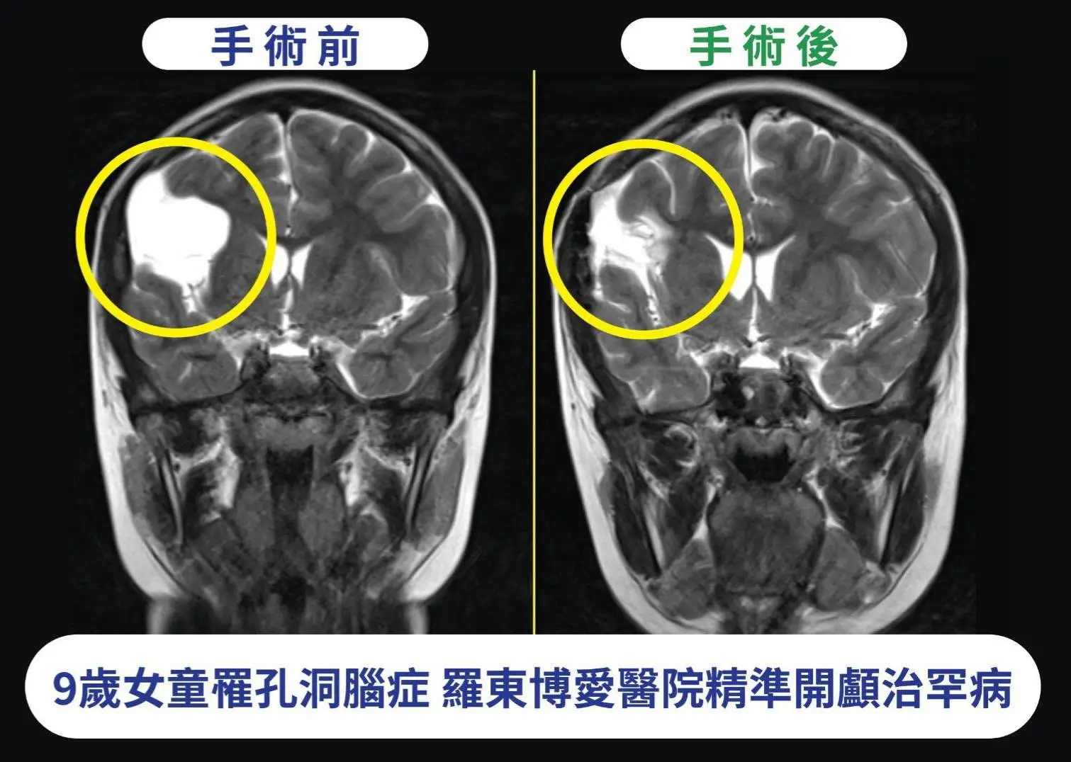 羅東博愛醫院